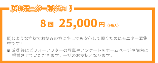 モニター 8回 25,000円(税込)